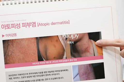 생기한의원 아토피 페이지에서 확인하는 유전·환경 요인 정보